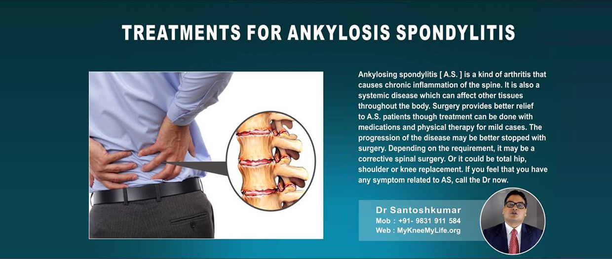 Dr. Santosh Kumar, Best Orthopedic Surgeon in Kolkata